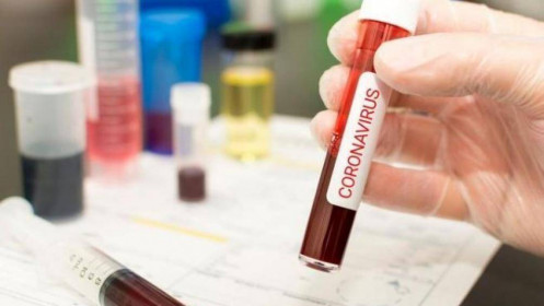 Nga bắt đầu thử nghiệm vaccine ngừa virus corona