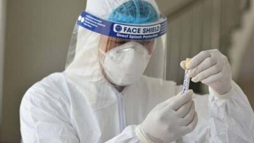 Vì sao xét nghiệm PCR của bệnh nhân COVID-19 đến lần 3 mới dương tính?