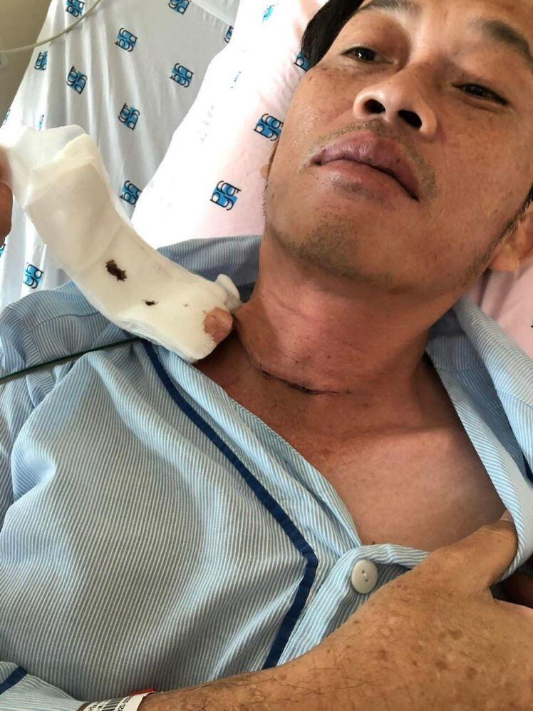 Hoài Linh tiết lộ phải phẫu thuật K tuyến giáp dẫn đến việc chậm trao số tiền từ thiện hơn 13 tỷ đồng cho bà con miền Trung sau lũ lụt