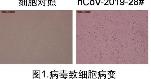 Trung Quốc phân lập được Covid-19 trong nước tiểu người bệnh