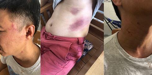 Thanh tra CA Kiên Giang có thẩm quyền giải quyết vụ đại úy CA Phú Quốc bị tố lừa đảo chiếm đoạt tài sản, đánh người tại trụ sở?