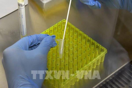 Dịch COVID-19: Các địa phương sẵn sàng nguồn lực xét nghiệm virus SARS-Cov-2 tại chỗ