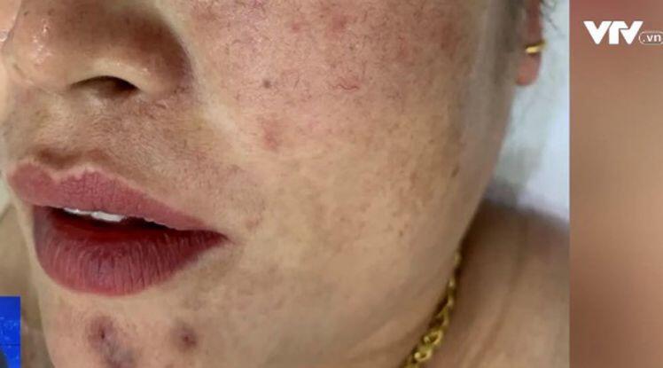'Mê hồn trận' mỹ phẩm không nguồn gốc, người tiêu dùng 'bấn loạn'