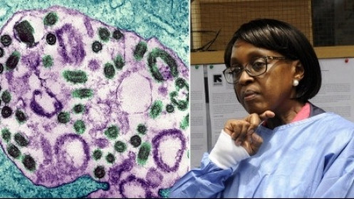 WHO khuyến cáo loại virus Marburg gây chết người "tái xuất"